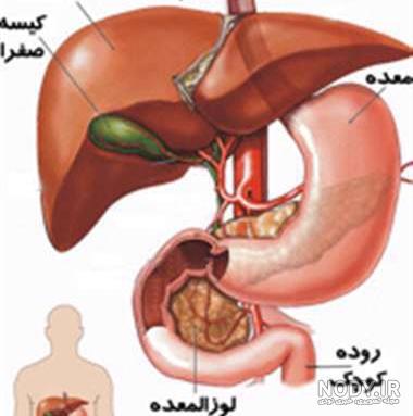 عکس سنگ صفرا در بدن