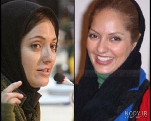 عکس قبل و بعد عمل زیبایی بازیگران ایرانی عکس قبل و بعد عمل زیبایی بازیگران ایرانی