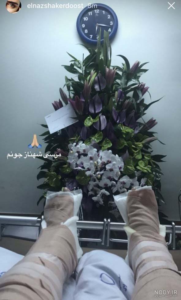 عکس ناخن پای الناز شاکردوست