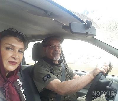 مینا نوروزی قبل از عمل بینی مینا نوروزی قبل از عمل بینی