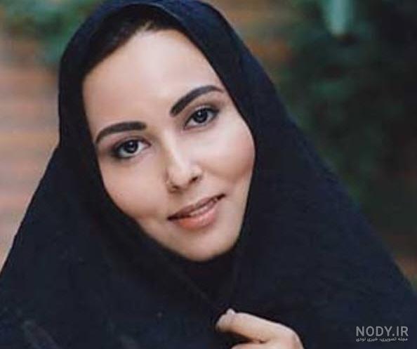 هانده ارچل قبل از عمل فک هانده ارچل قبل از عمل فک