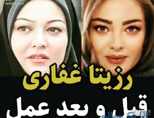 چهره جدید رزیتا غفاری چهره جدید رزیتا غفاری