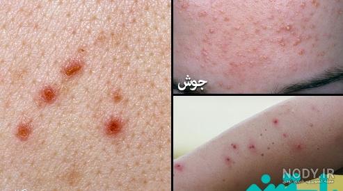 گال از چی به وجود میاد