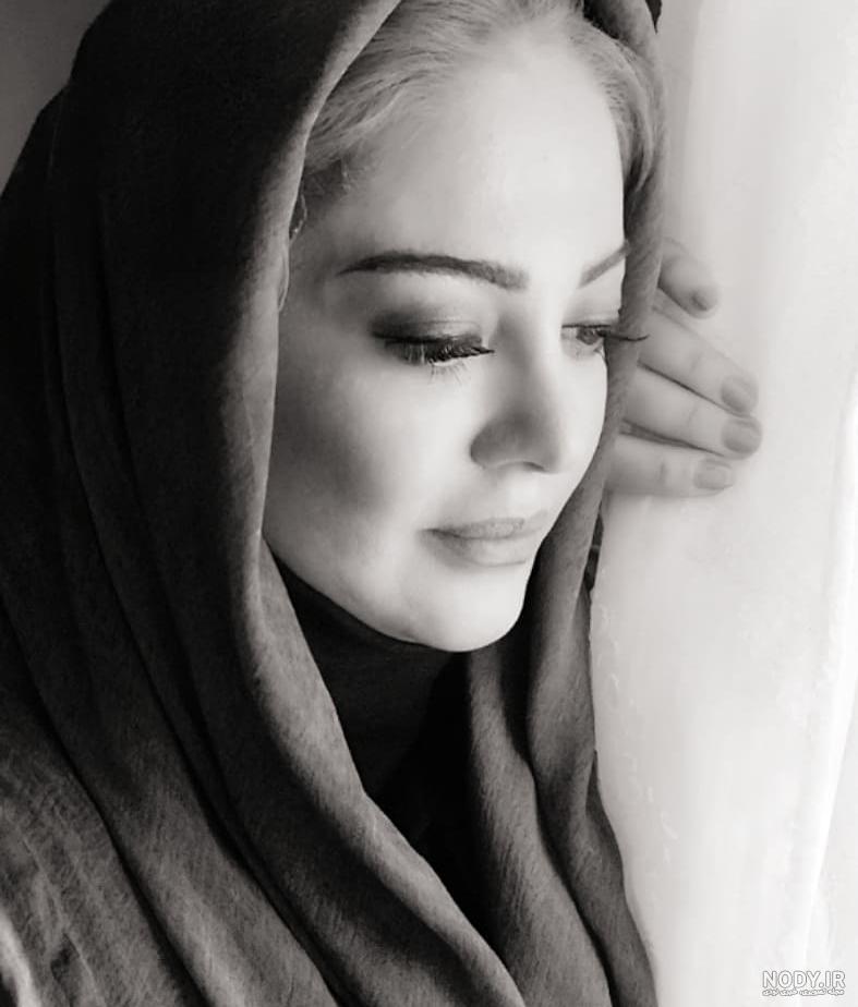 گلشن قیزی قبل عمل گلشن قیزی قبل عمل