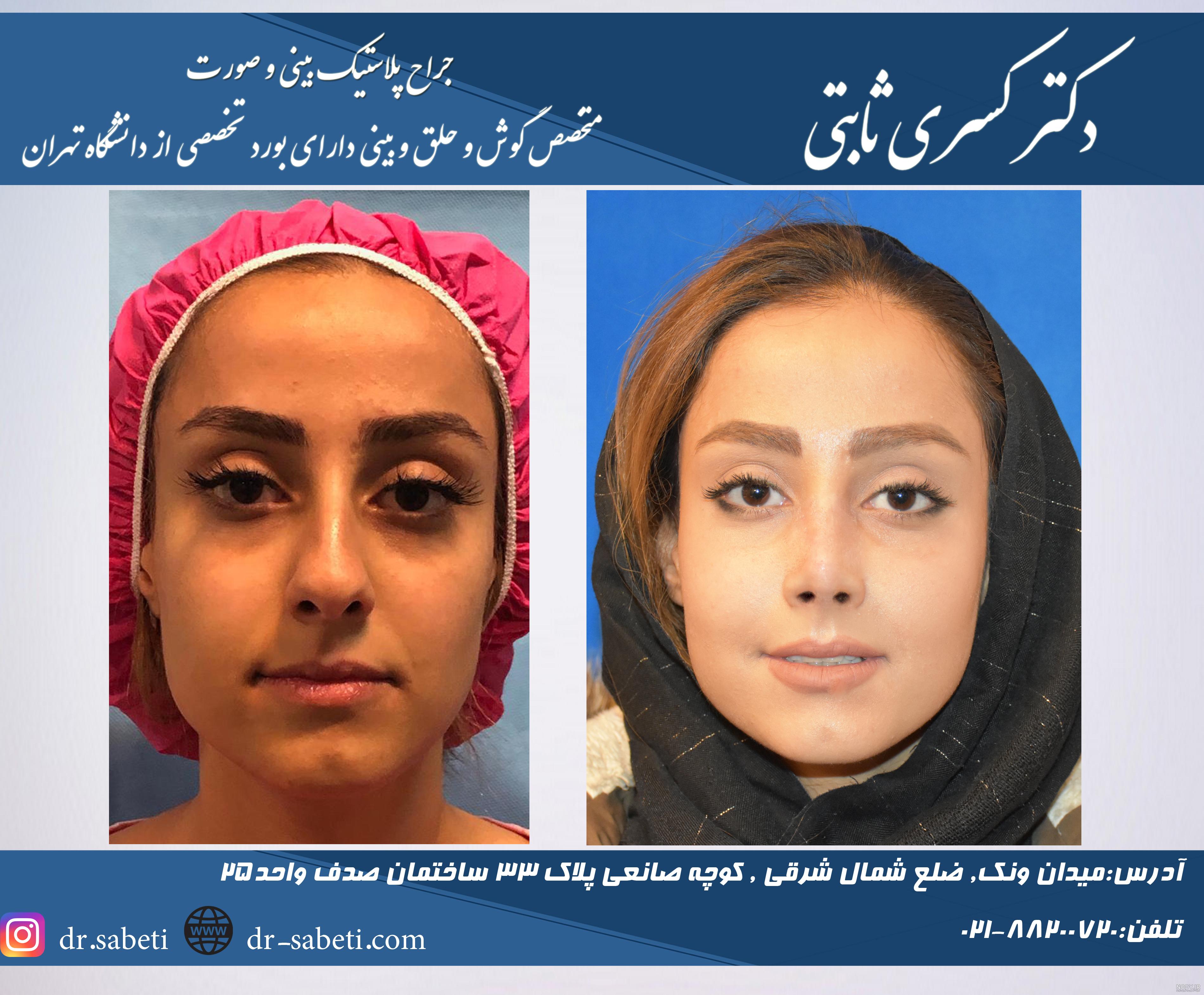 تصاویر کاشت گونه