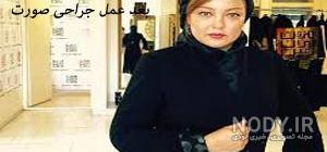 تغییر چهره رزیتا غفاری