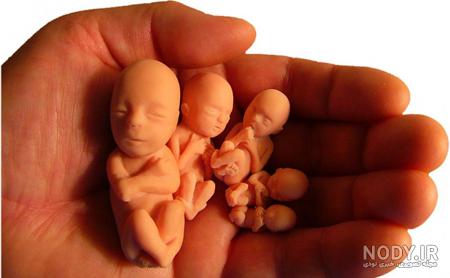 رنگ جنین سقط شده پسر نی نی سایت