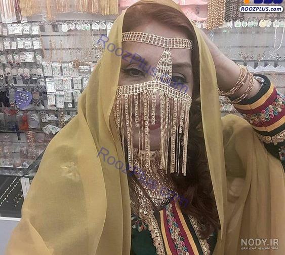 زهره حمیدی بعد از عمل