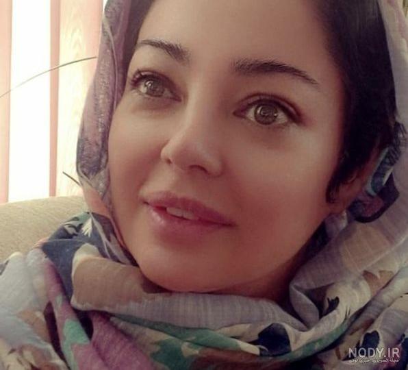 علت تغییر چهره رزیتا غفاری