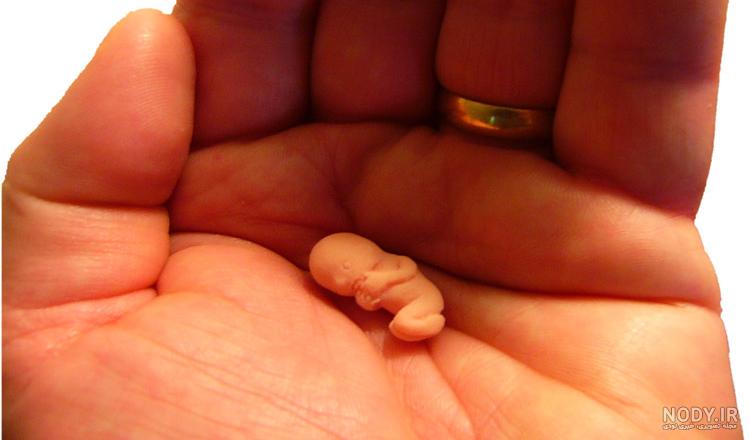 عکس جنین 20 روزه سقط شده