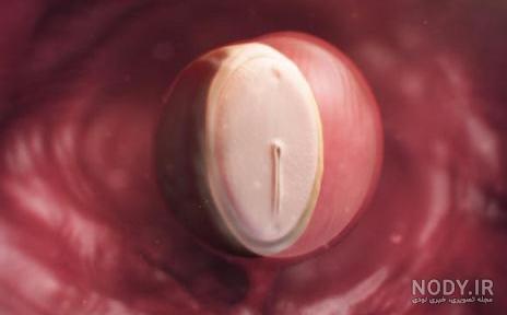 عکس جنین سقط شده دختر