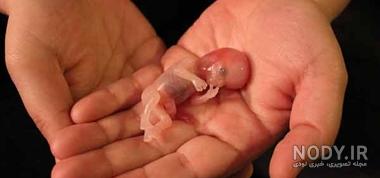 عکس جنین سقط شده دو هفته ای