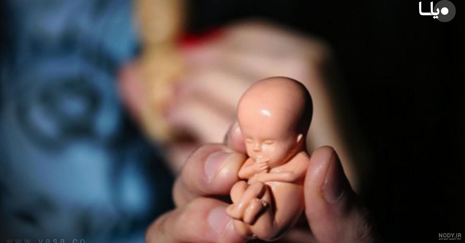 عکس جنین سقط شده پنج هفته ای