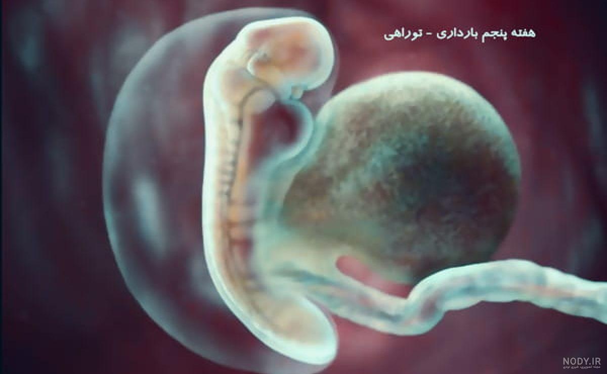 عکس جنین سقط شده چهار هفته ای