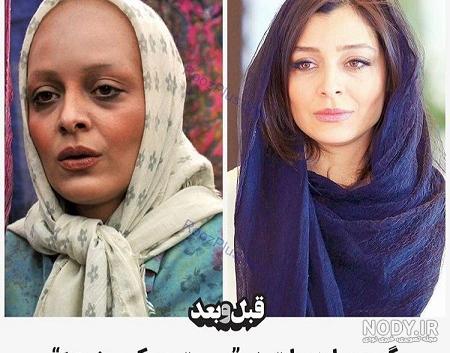 عکس ساره بیات قبل عمل عکس ساره بیات قبل عمل