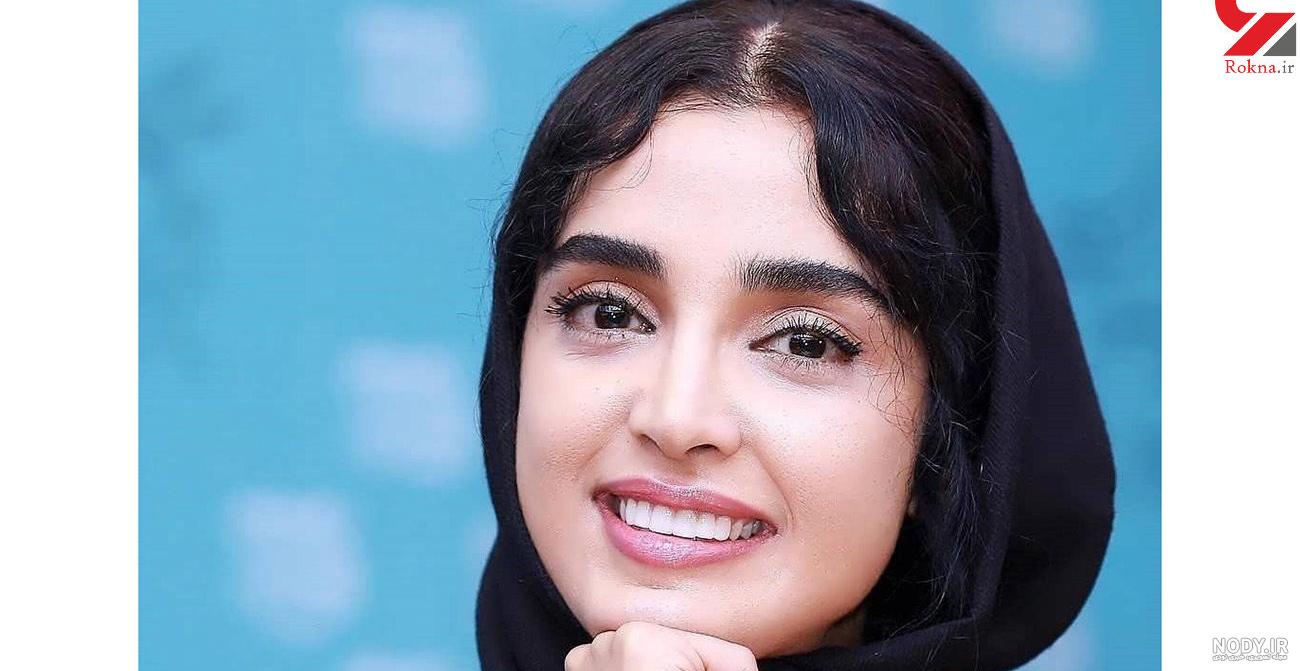 عکس سینا مهراد قبل از عمل بینی عکس سینا مهراد قبل از عمل بینی