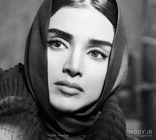 فرناز رهنما قبل از عمل بینی
