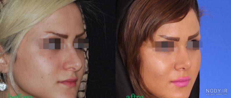قیمت کاشت گونه