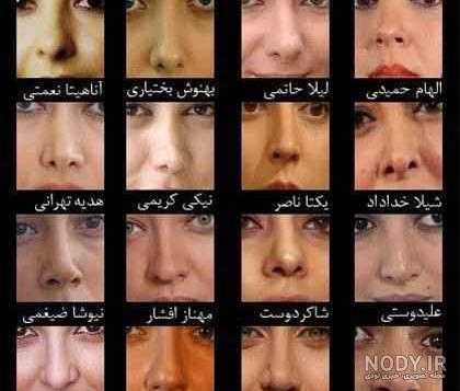 نسرین مقانلو قبل از عمل بینی نسرین مقانلو قبل از عمل بینی