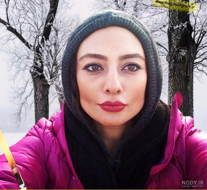 هنسک احمد قبل از عمل بینی