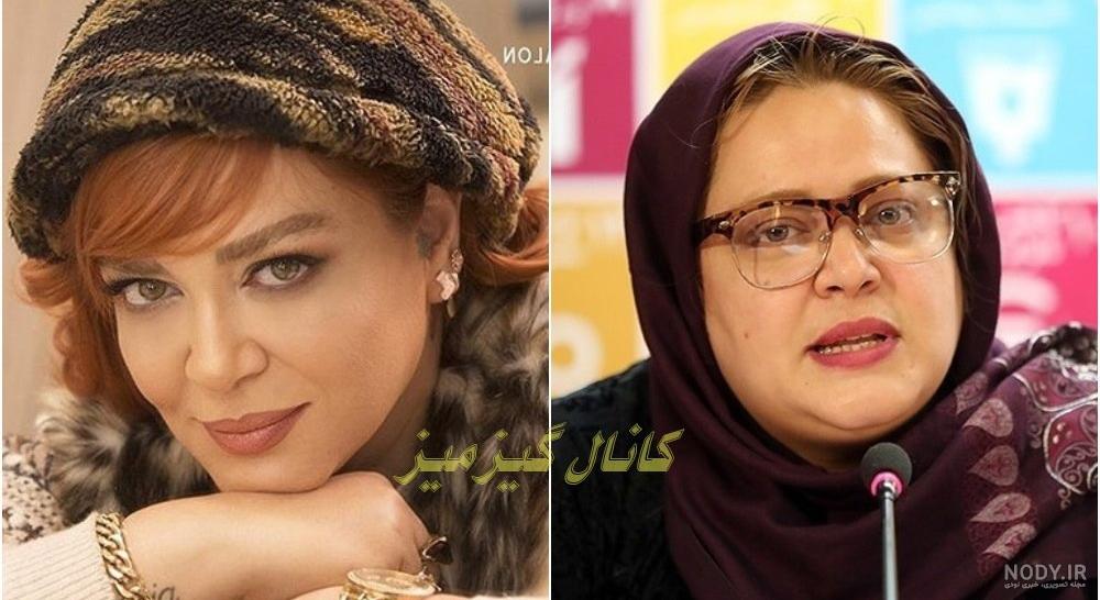 بهاره رهنما قبل و بعد بهاره رهنما قبل و بعد
