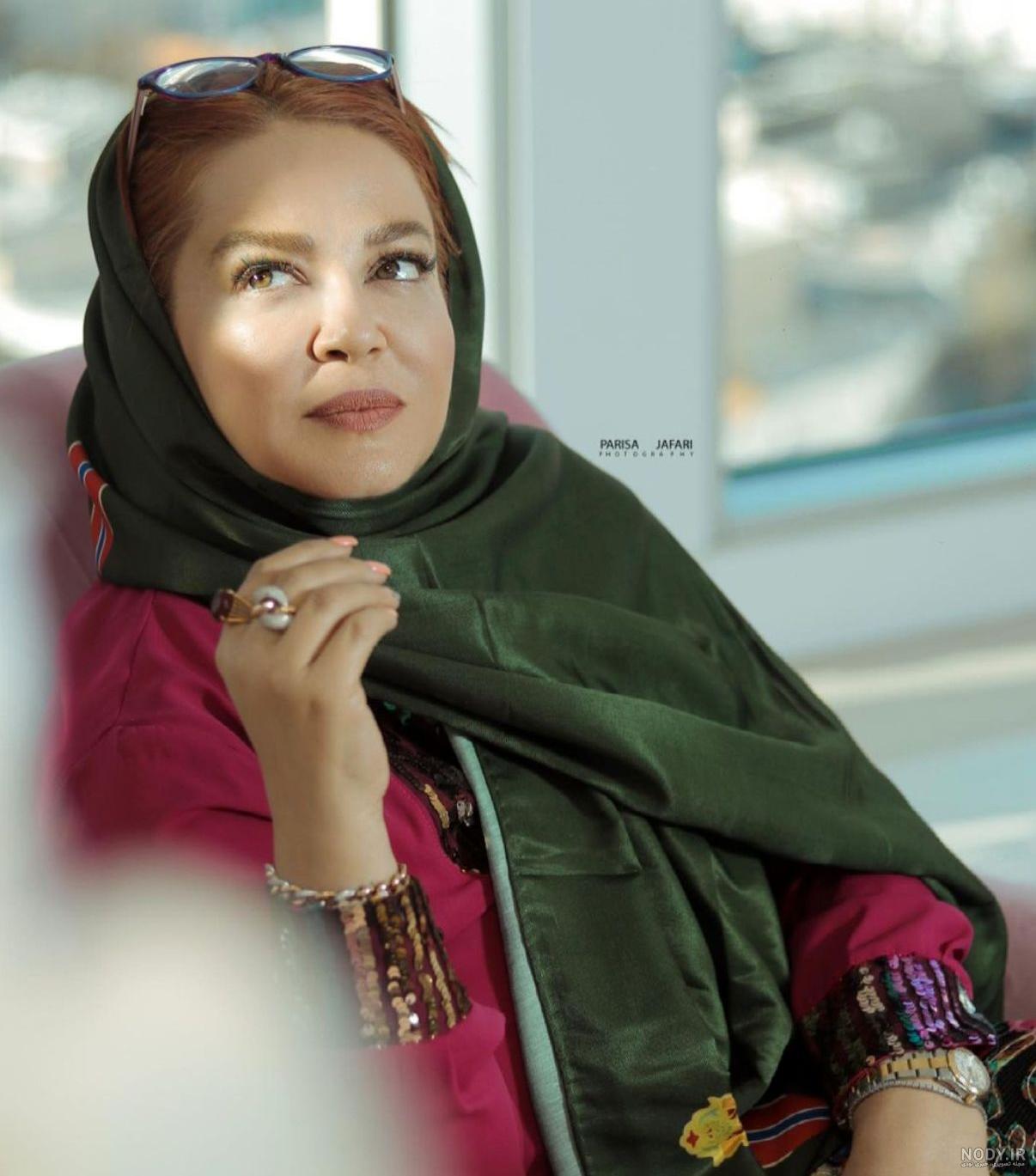 بهاره رهنما قبل و بعد عمل بینی بهاره رهنما قبل و بعد عمل بینی