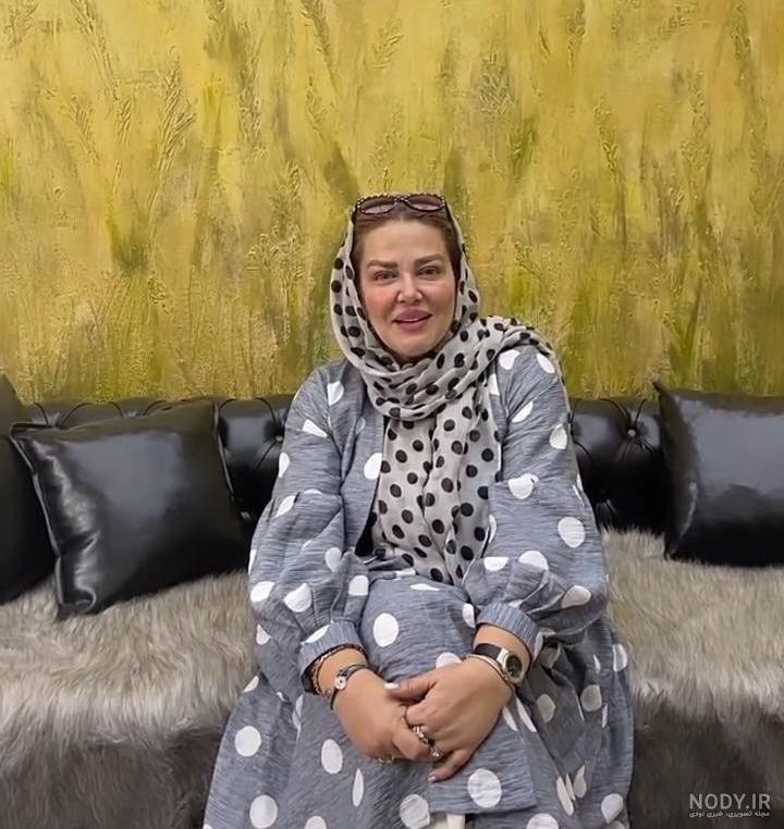 بهاره رهنما قبل و بعد عمل بینی بهاره رهنما قبل و بعد عمل بینی