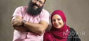 عکس سولماز آقمقانی قبل از عمل عکس سولماز آقمقانی قبل از عمل