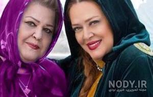 نعیمه نظام دوست قبل و بعد از عمل نعیمه نظام دوست قبل و بعد از عمل