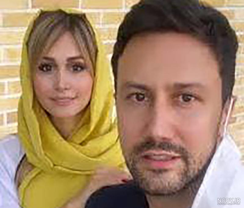 سپیده بزمی پور قبل از عمل نی نی سایت سپیده بزمی پور قبل از عمل نی نی سایت