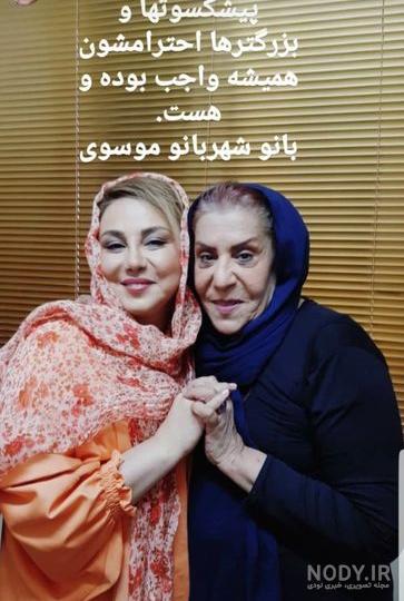 شهربانو موسوی عمل زیبایی شهربانو موسوی عمل زیبایی