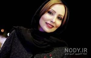 عکس بازیگران ترکیه قبل و بعد از عمل زیبایی