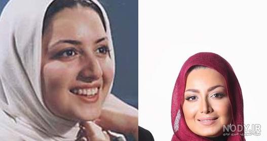 عکس بازیگران مرد ایرانی قبل و بعد از عمل زیبایی