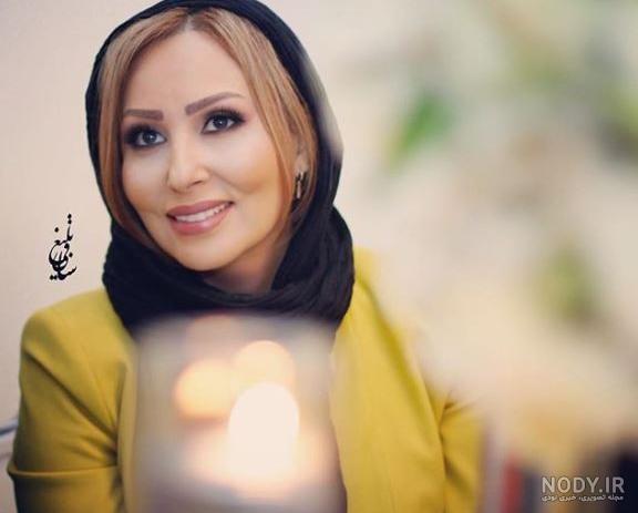 عکس نیکی کریمی قبل از عمل زیبایی