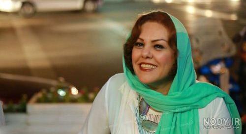 افسانه چهره آزاد قبل از عمل افسانه چهره آزاد قبل از عمل