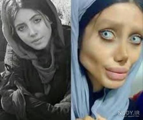 حمله زامبی زامبی واقعی