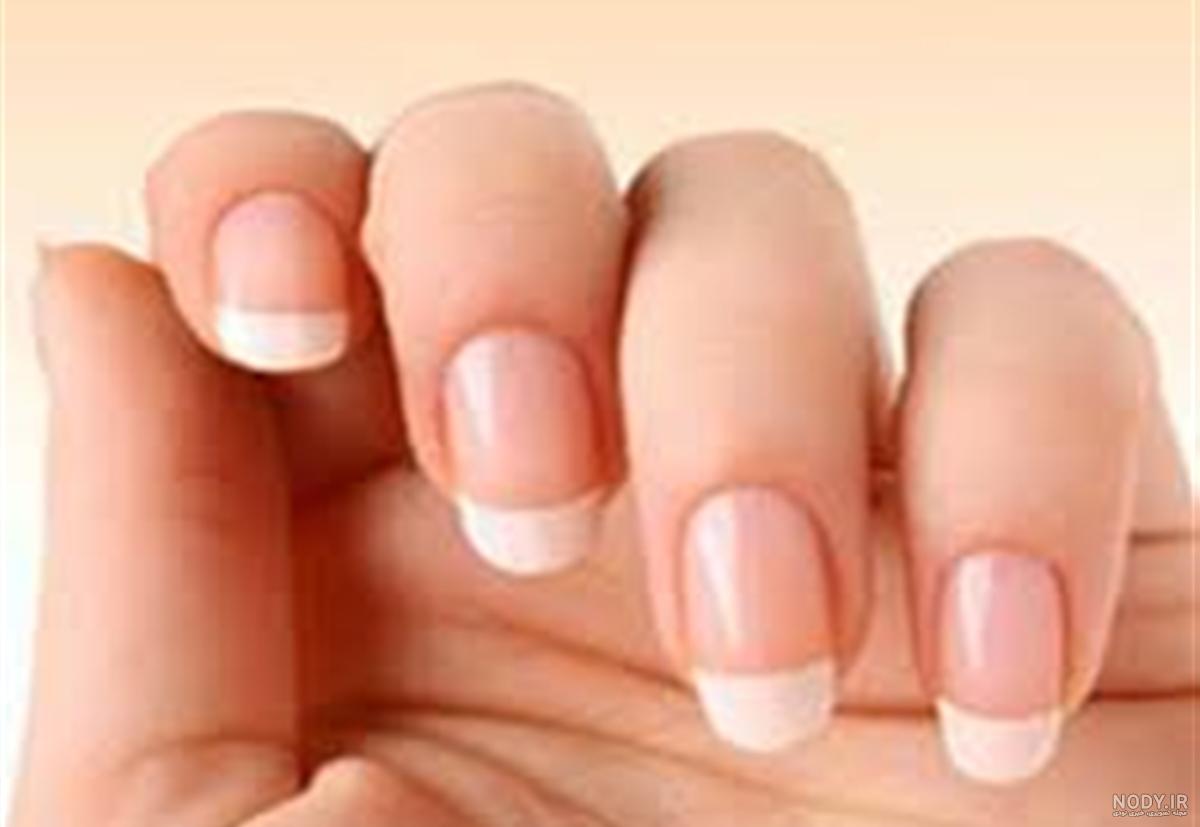 عوارض لمینت ناخن عوارض لمینت ناخن