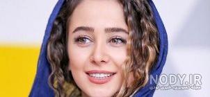 عکس الناز حبیبی قبل از عمل