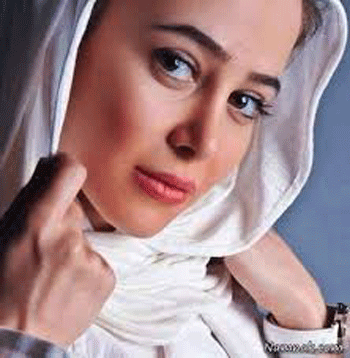 عکس الناز حبیبی قبل از عمل دماغ