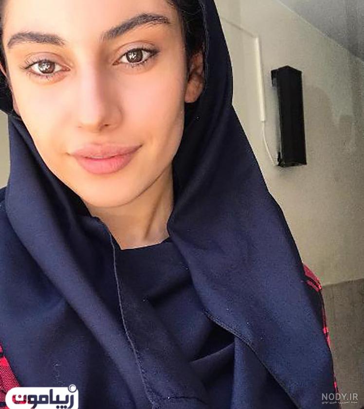 عکس ترلان پروانه قبل از عمل زیبایی