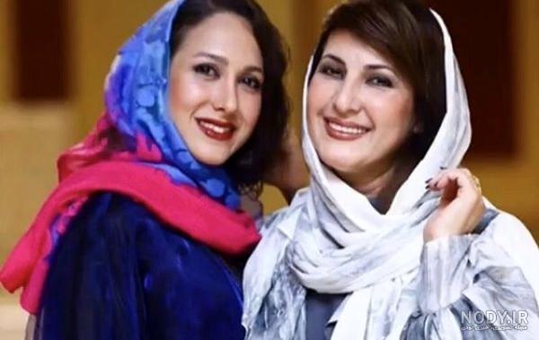 عکسهای نیکی کریمی قبل از عمل زیبایی