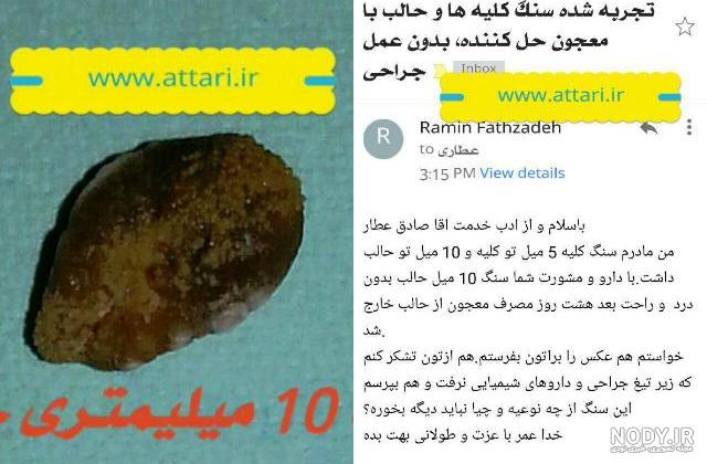 انواع سنگ کلیه pdf انواع سنگ کلیه pdf