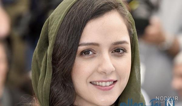ترانه علیدوستی قبل و بعد از عمل