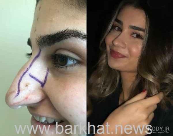 دنیا جهانبخت کجاشو عمل کرده دنیا جهانبخت کجاشو عمل کرده