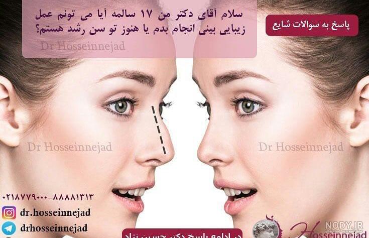 عمل لیپوماتیک دنیا جهانبخت عمل لیپوماتیک دنیا جهانبخت