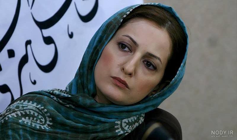 عکس شقایق دهقان بعد از عمل بینی عکس شقایق دهقان بعد از عمل بینی