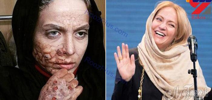 بازی زامبی خنده دار بازی زامبی خنده دار