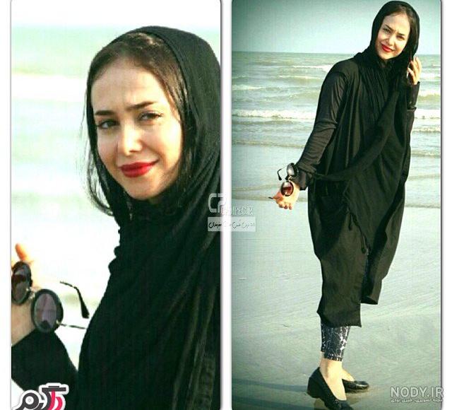 عکس الناز حبیبی قبل از عمل