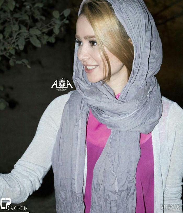 عکس الناز حبیبی قبل از عمل