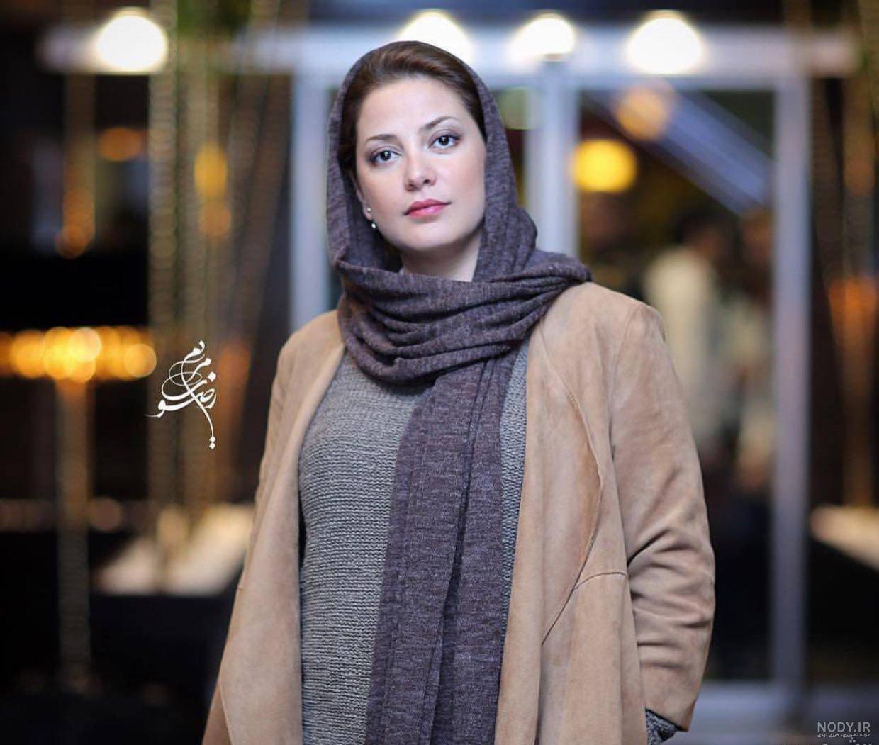 عکس طناز طباطبایی قبل از عمل